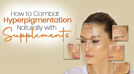 How to Fight Hyperpigmentation with Supplements the Natural Way in Pakistan